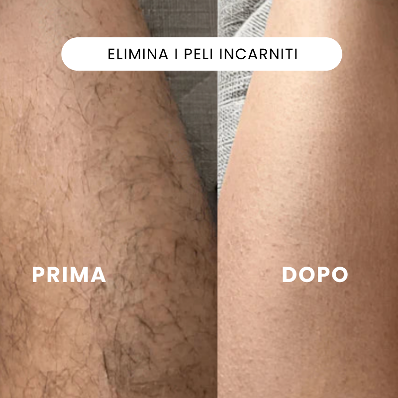 Rasoio elettrico 2 in 1 per una pelle liscia senza irritazioni
