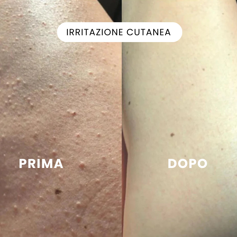 Rasoio elettrico 2 in 1 per una pelle liscia senza irritazioni
