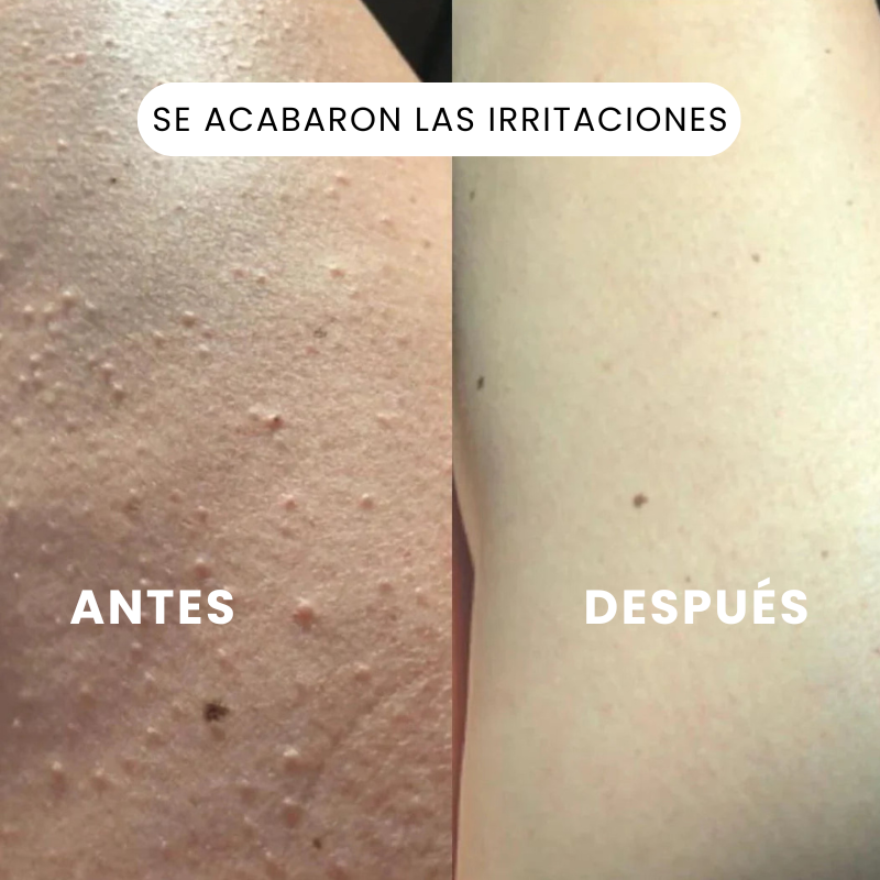 Maquinilla de afeitar eléctrica 2 en 1 para piel suave sin irritación