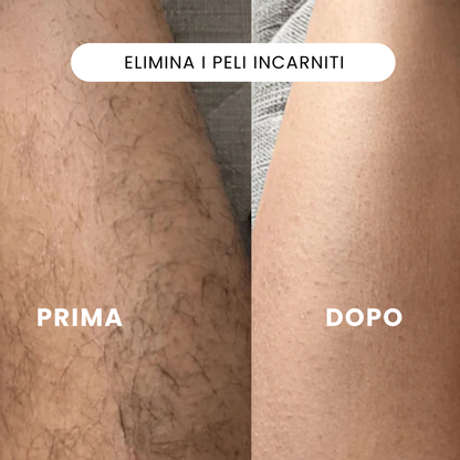Rasoio elettrico 2 in 1 per una pelle liscia senza irritazioni